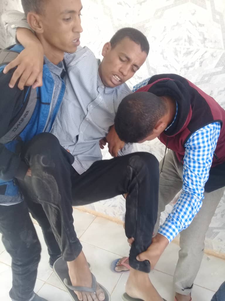 طالب أصيب خلال تفريق الشرطة للمتظاهرين 