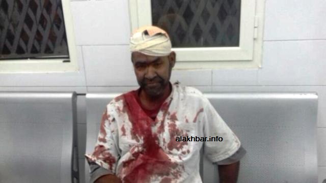 أحد المصابين في النزاع مساء اليوم بعيد تلقيه العلاج في مستشفى الشيخ زايد بنواكشوط
