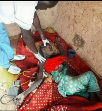 أحد المصابين بسوء التغذية في قرية الزرافية شرقي موريتانيا