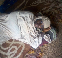 إحدى الصور التي أرفقها الوفد البرلماني مع بيانه، وقال إنها لإحدى المصابات جراء سوء التغذية في المنطقة